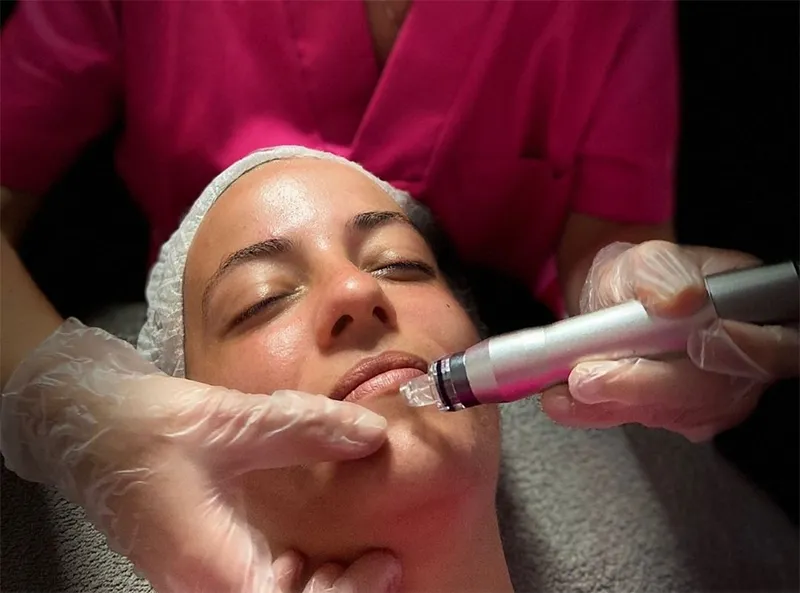 Hidratación Facial